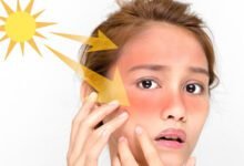 4 نصائح لحماية البشرة من الشمس والإجهاد