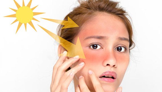 4 نصائح لحماية البشرة من الشمس والإجهاد