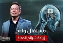 إيلون ماسك يراهن على مستقبل واعد لتقنية زراعة شرائح الدماغ