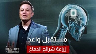 إيلون ماسك يراهن على مستقبل واعد لتقنية زراعة شرائح الدماغ