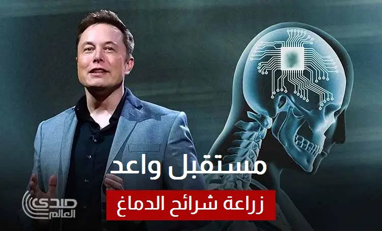 إيلون ماسك يراهن على مستقبل واعد لتقنية زراعة شرائح الدماغ
