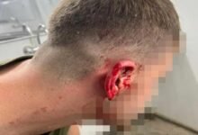 فئران تأكل وجوه جنود إسرائيليين تسببت في ذعر داخل جيش الإحتلال