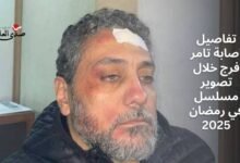 تفاصيل إصابة تامر فرج خلال تصوير مسلسل في رمضان 2025