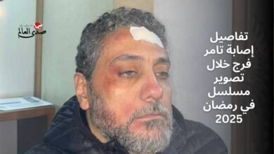 تفاصيل إصابة تامر فرج خلال تصوير مسلسل في رمضان 2025